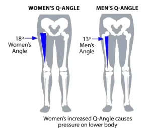 Q angle punca sakit lutut bagi wanita 