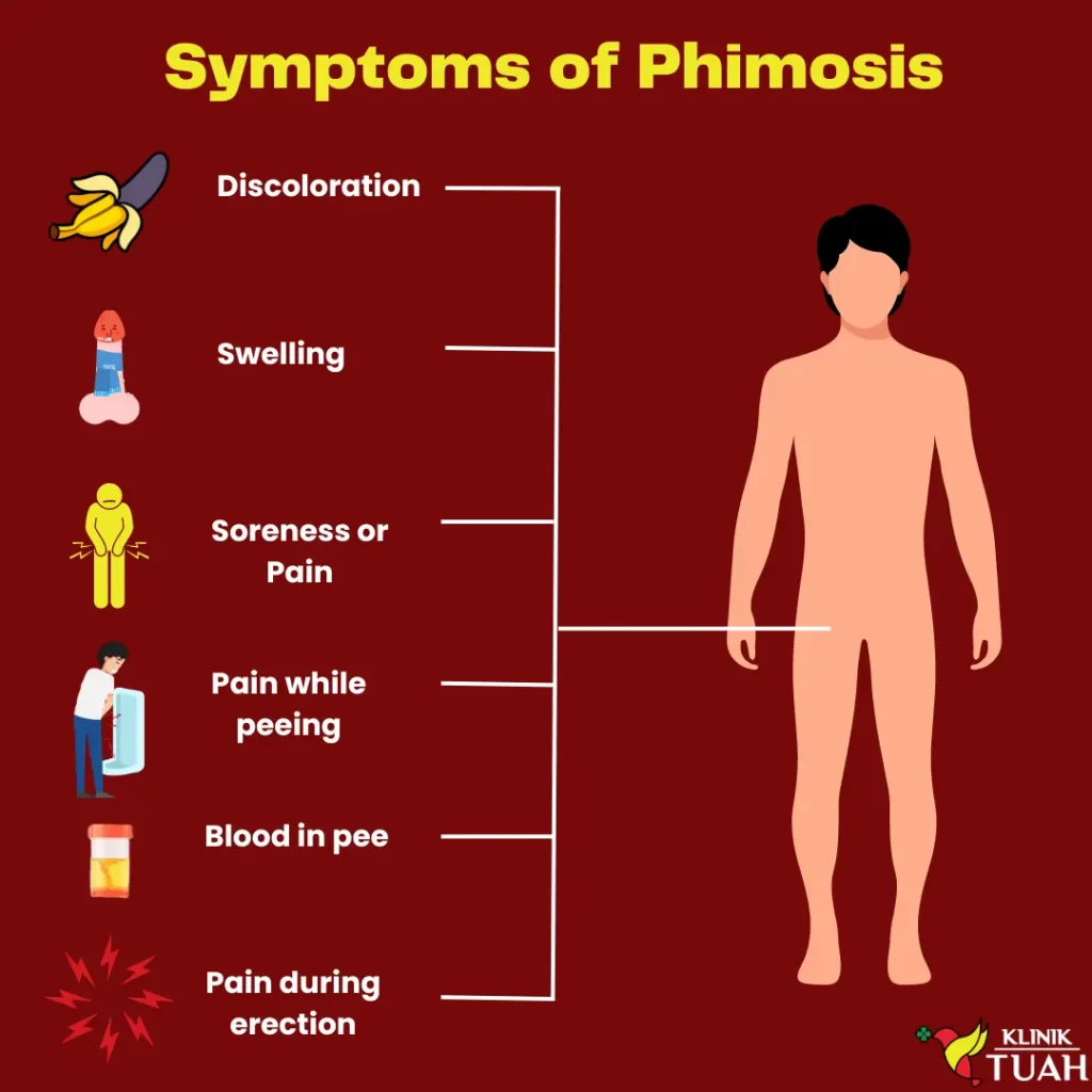 Symptoms of Phimosis from uncircumcision Klinik Tuah