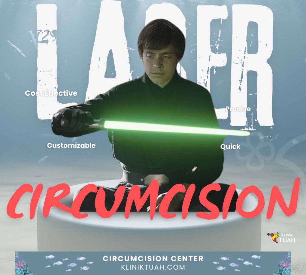 laser circumcision