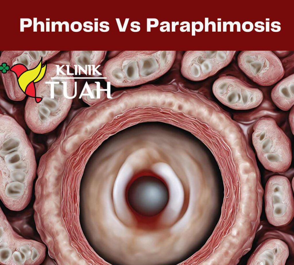 phimosis vs paraphimosis