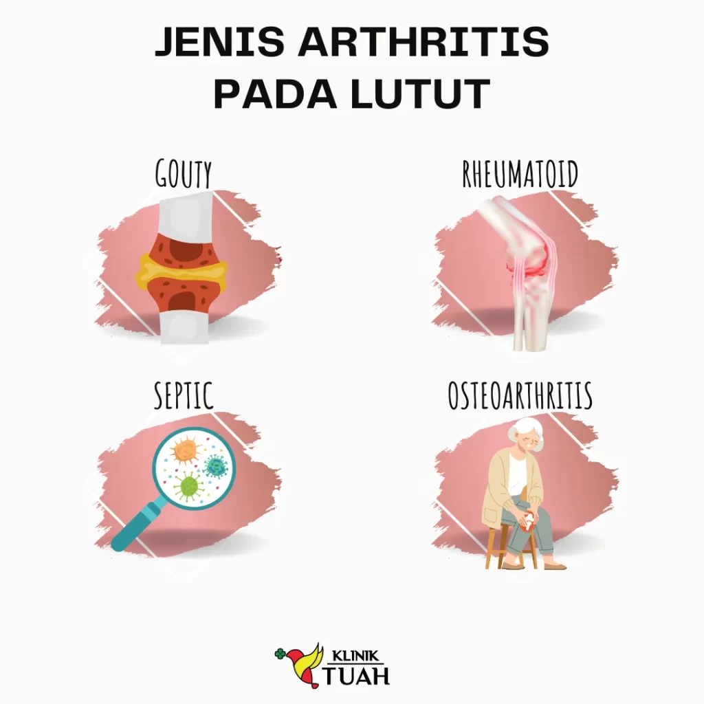 jenis arthritis klinik sakit lutut di kuantan klinik tuah