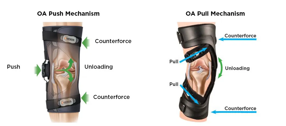 Knee braces help in dealing with chronic pain klinik tuah