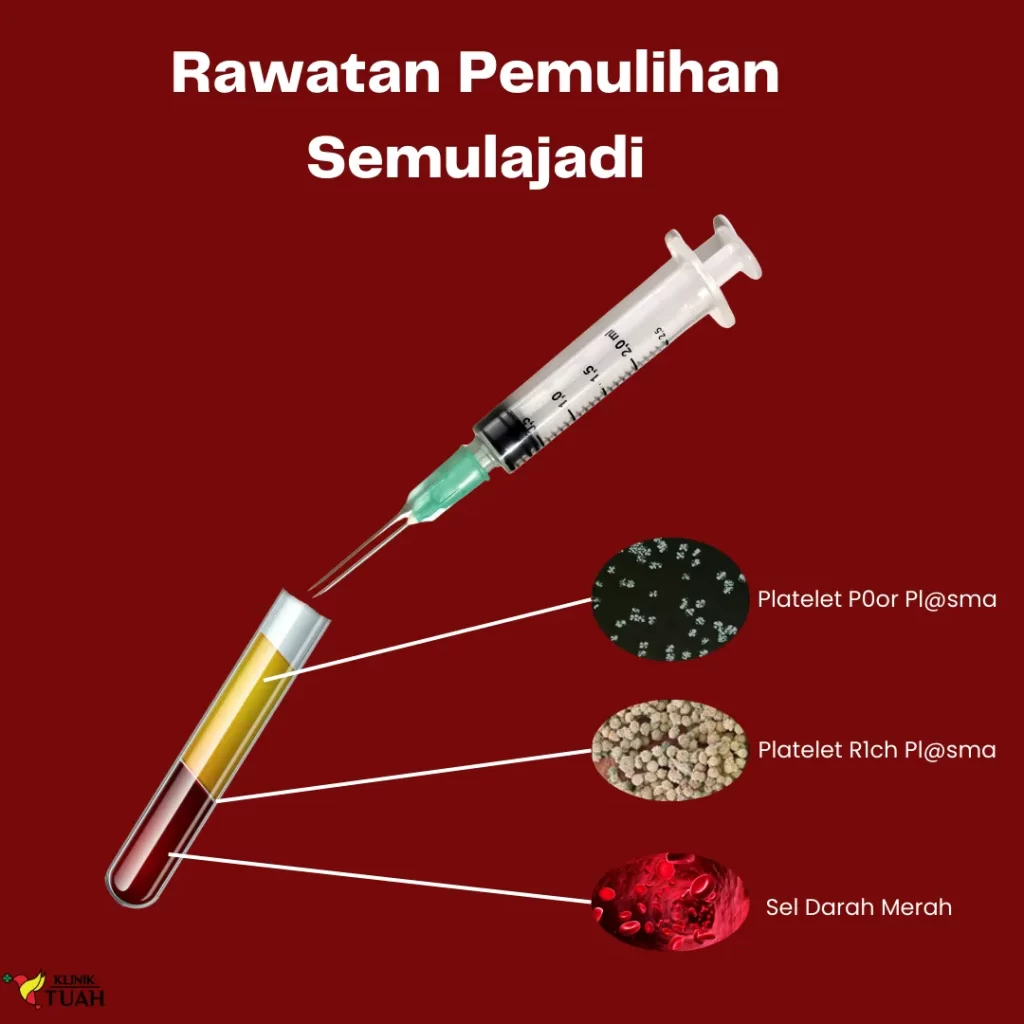 rawatan pemulihan semula jadi klinik tuah