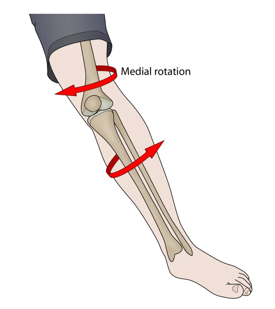twisted knee injury causes knee effusion