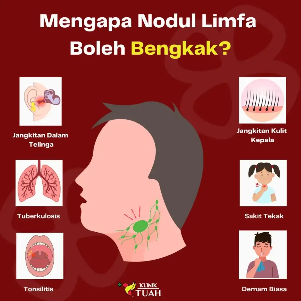 nodul bengkak punca benjolan di leher