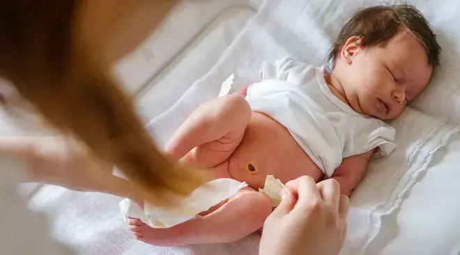 sunat ketika bayi mudah menjaga luka- Klinik Sunat Bayi di Kuantan Klinik Tuah