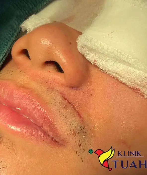 Pembedahan klinik (33)