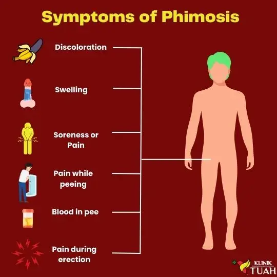 symptoms of phimosis with circumcision as treatment
