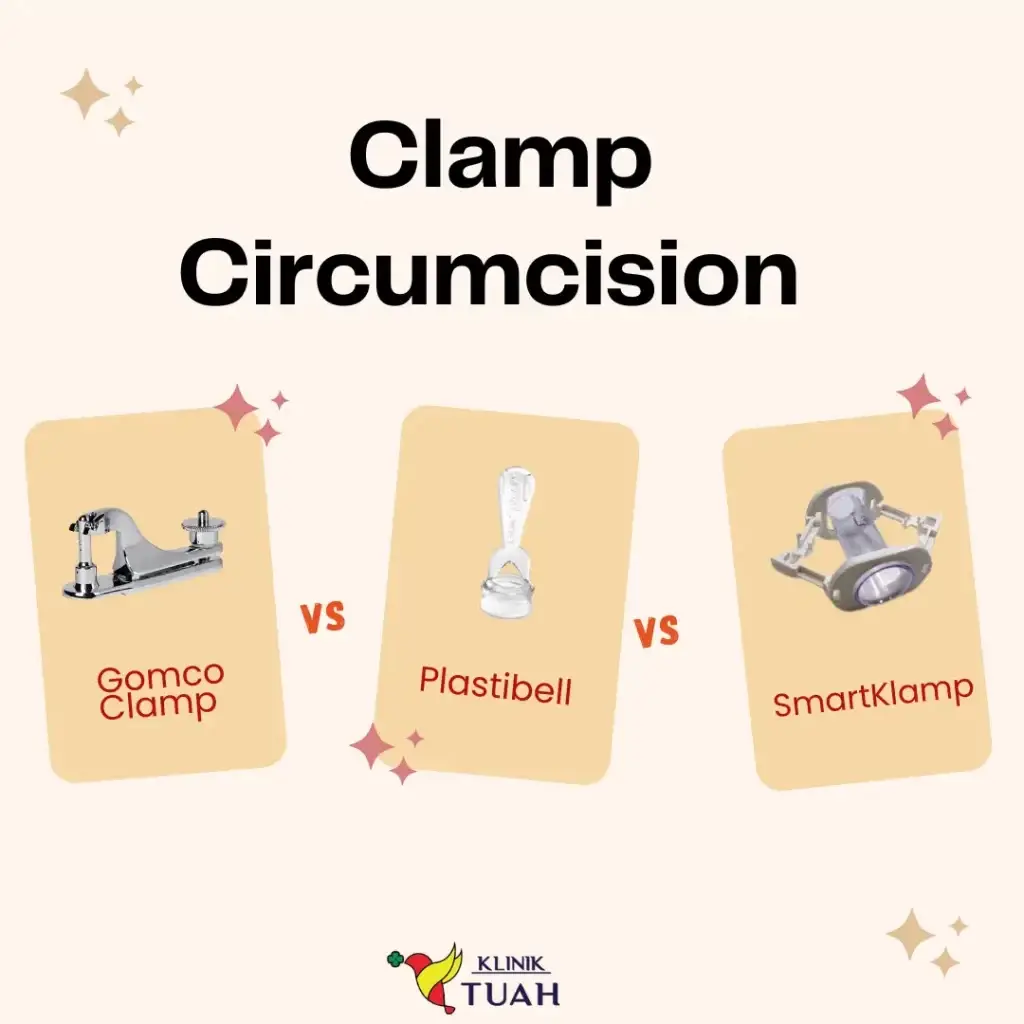 type of clamp circicumcision