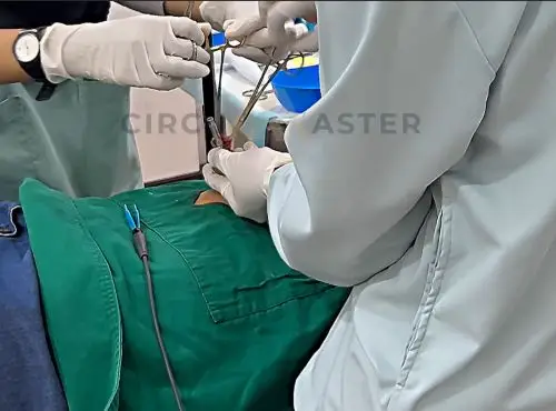 consider surgery to fox phimosis