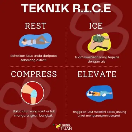 Rawatan jenis sakit lutut koyakan meniscus antaranya ialah RICE