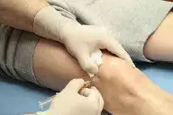 klinik pakar sakit lutut menawarkan suntikan gel lutut sebagai rawatan