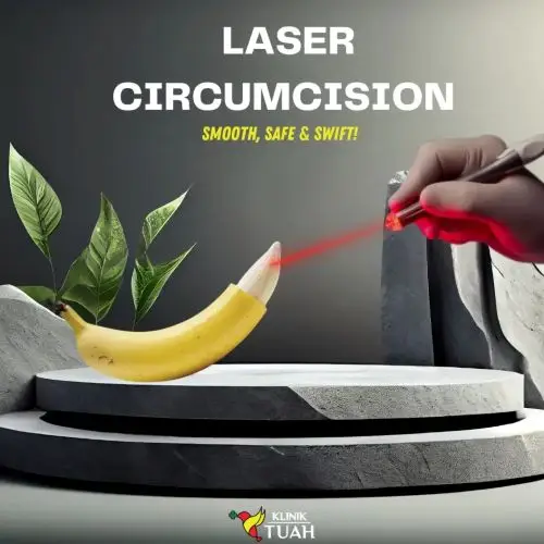 laser circumcision become popular due to smooth, safe and swift procedure
