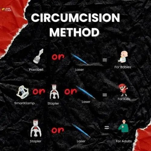 3teknik khatan dalam artikel sebab luka sunat lambat sembuh