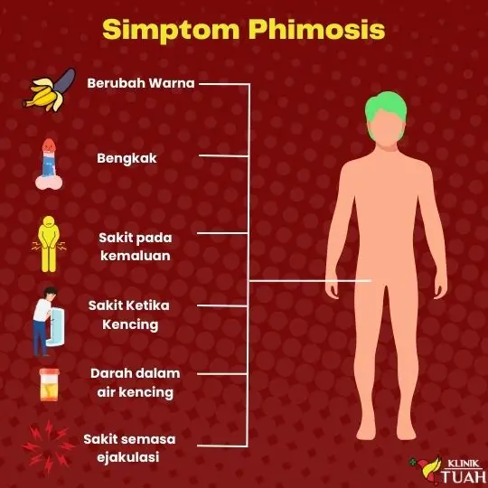 manfaat sunat lelaki adalah mencegah phimosis