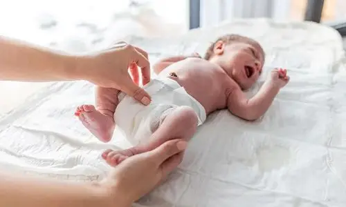 sentiasa tukar lampin bayi antara capa penjagaan selepas sunat plastibell