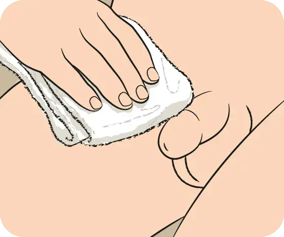 pat dry wound during post circumcision care