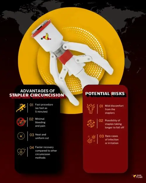 infographic on stapler circumcision advantages under post circumcision care article