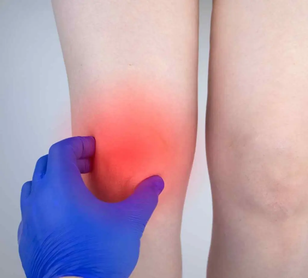 septic arthritis menyebabkan radang dan sakit lutut