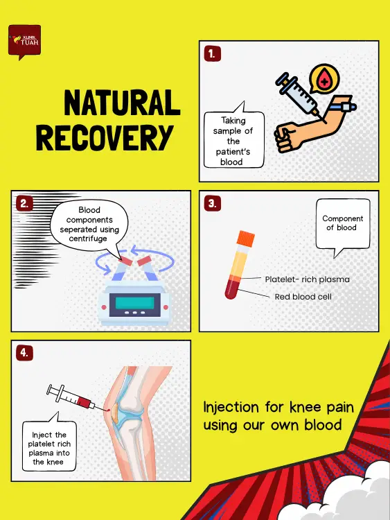 natural recovery procedure as one of injection for knee injuries