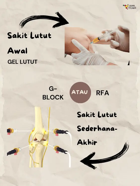 Rawatan RFA dan GNB Lutut di KL dan Selangor biasanya untuk sakit lutut kronik